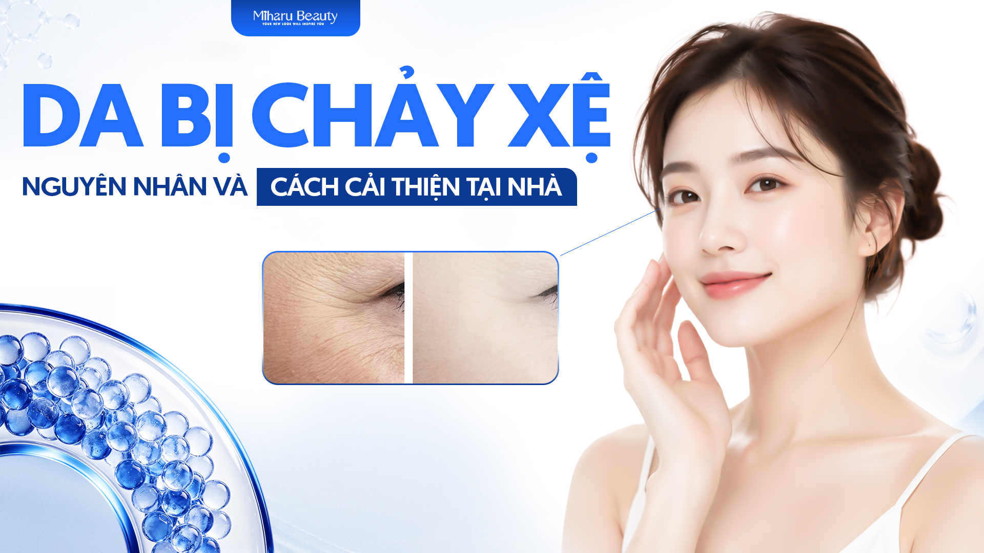 Da bị chảy xệ? Nguyên nhân và cách cải thiện ngay tại nhà.