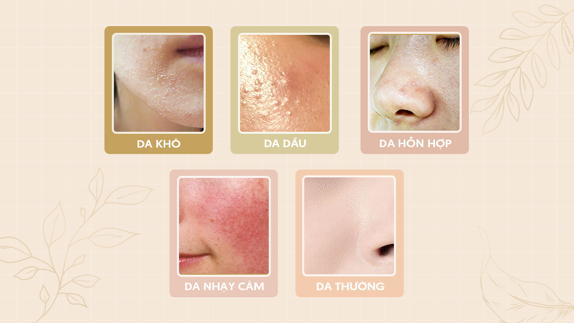 Các loại da cơ bản