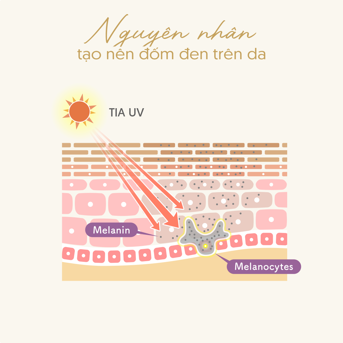 Nguyên nhân tạo nên đốm đen trên da