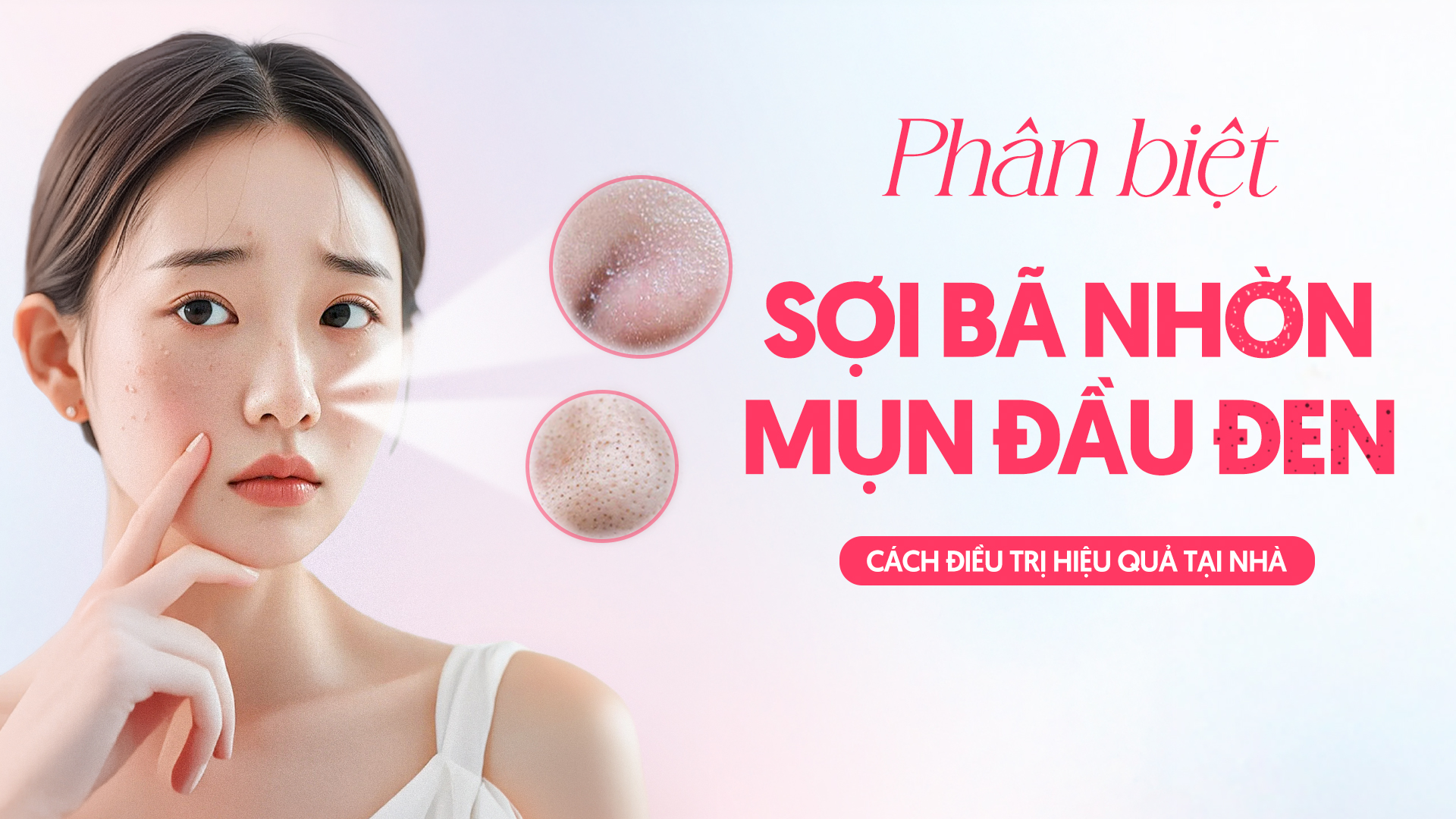 Phân Biệt Sợi Bã Nhờn Và Mụn Đầu Đen: Cách Điều Trị Hiệu Quả Tại Nhà.