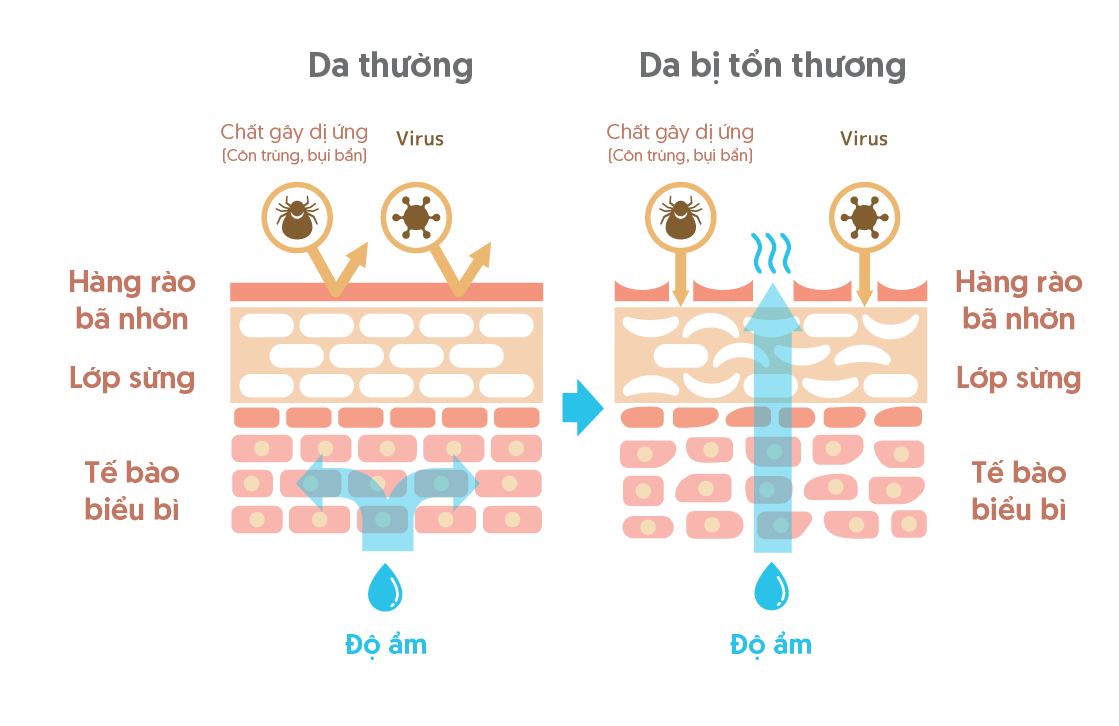 Nguy cơ làn da bị nhiễm trùng