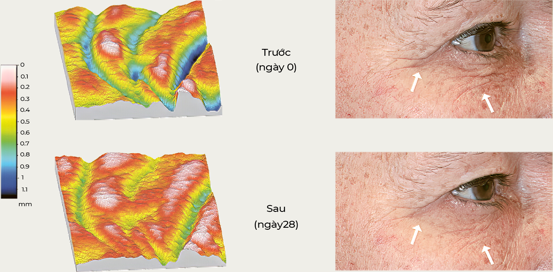 Cách thức hoạt động của tế bào noãn thực vật trên da