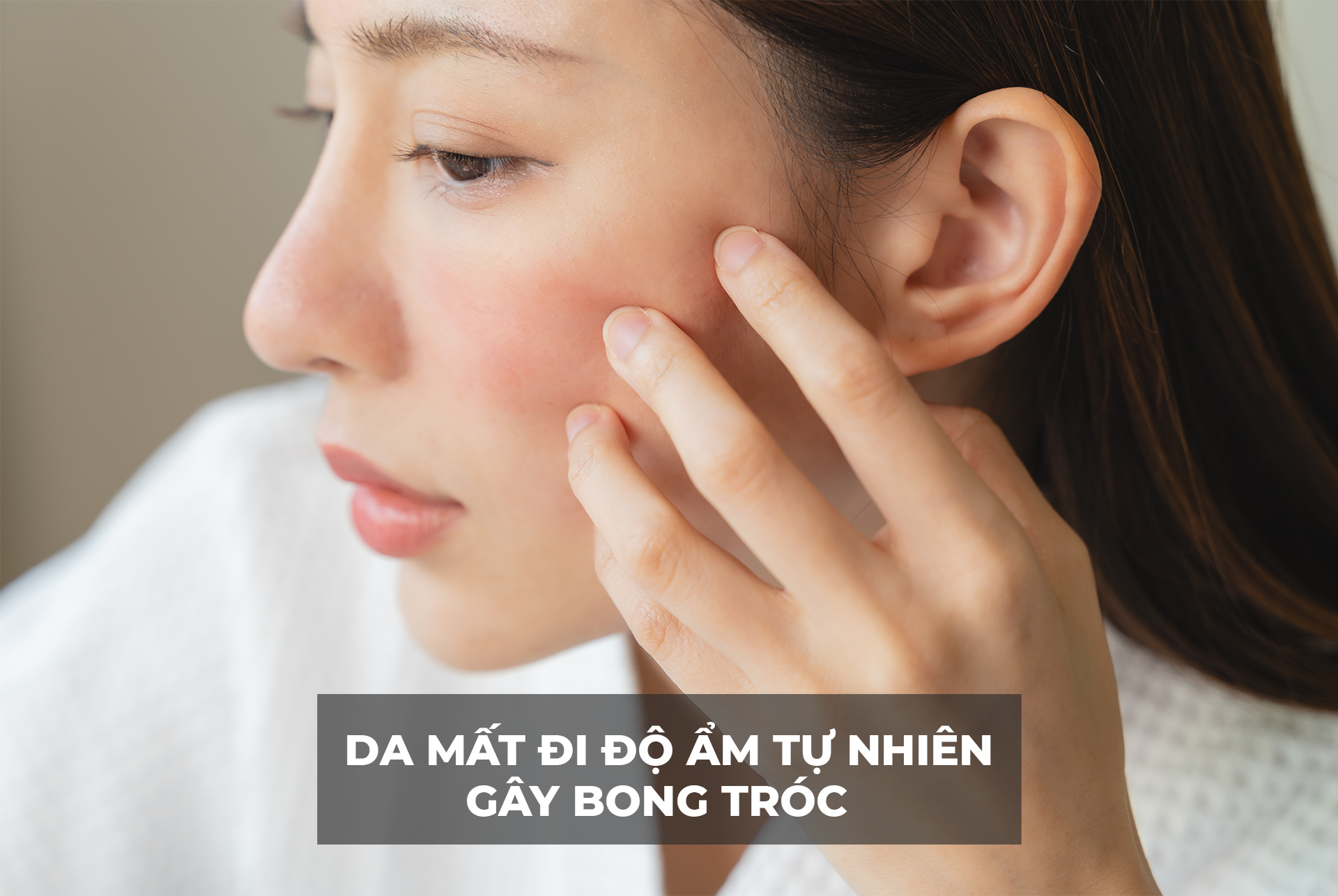 Da bị mất độ ẩm tự nhiên gây bong tróc