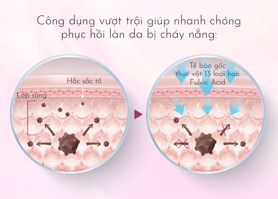 Công dụng vượt trội giúp nhanh chóng phục hồi làn da bị cháy nắng