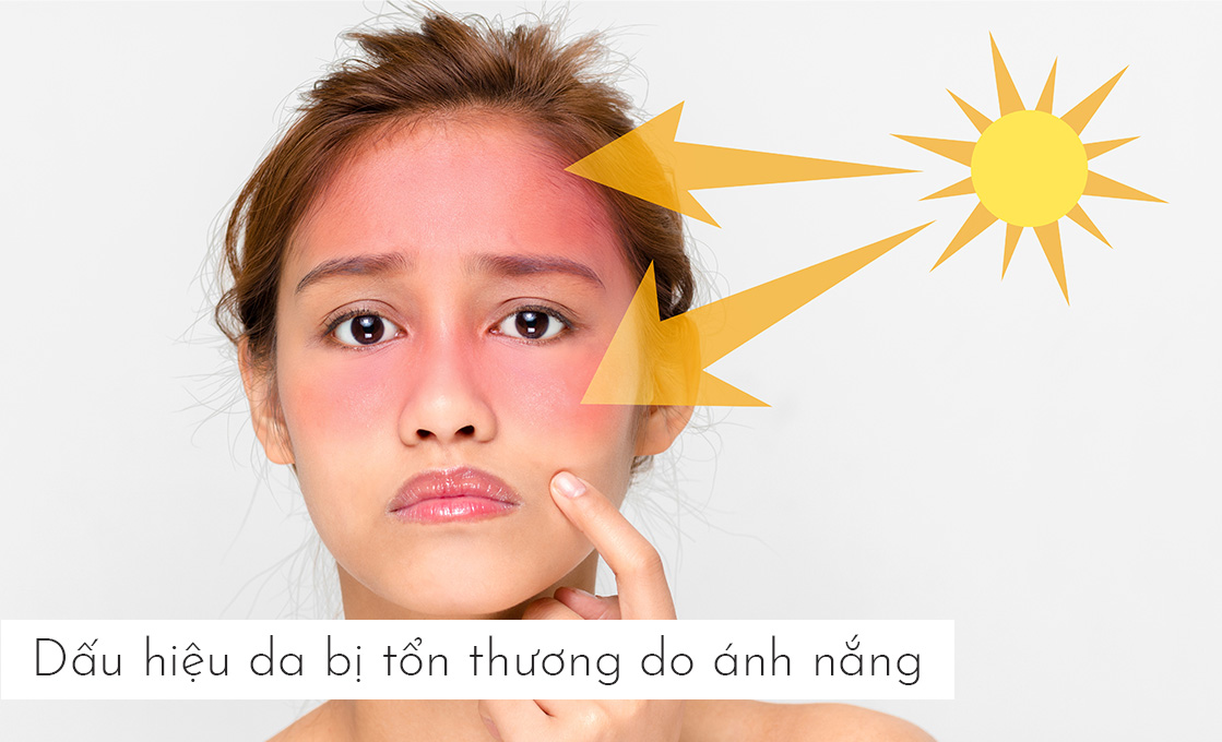 Dấu hiệu da bị tổn thương do ánh nắng