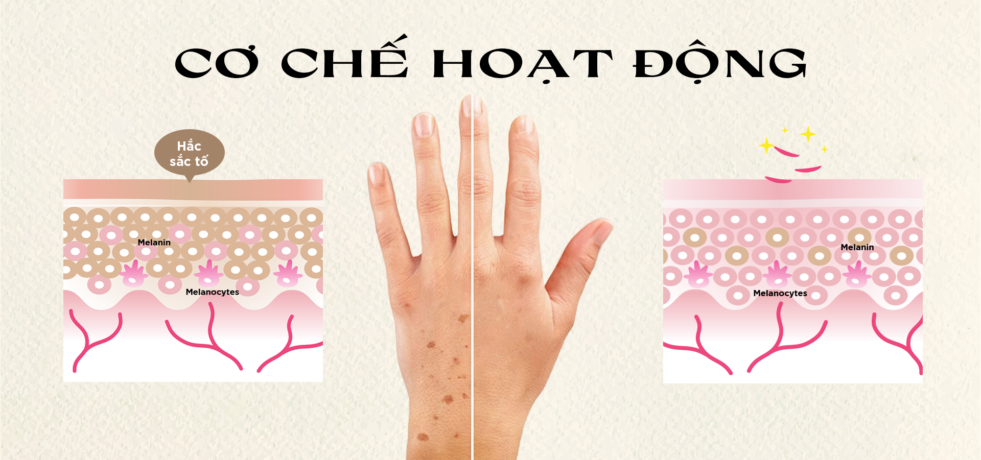 Cơ chế hoạt động của nám da tay