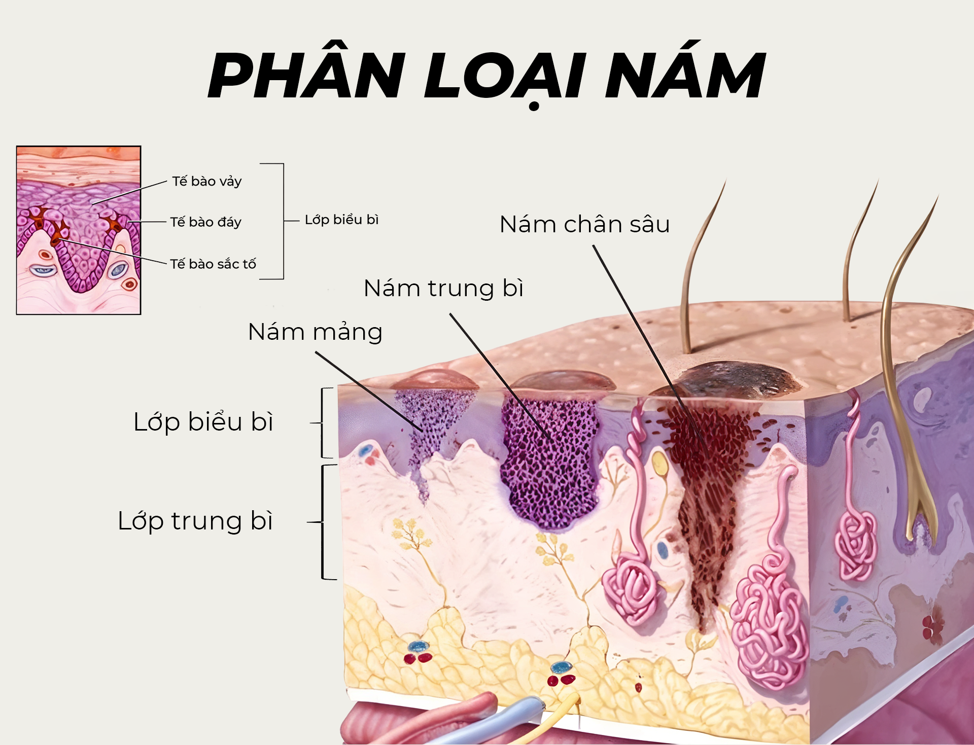 Phân loại nám