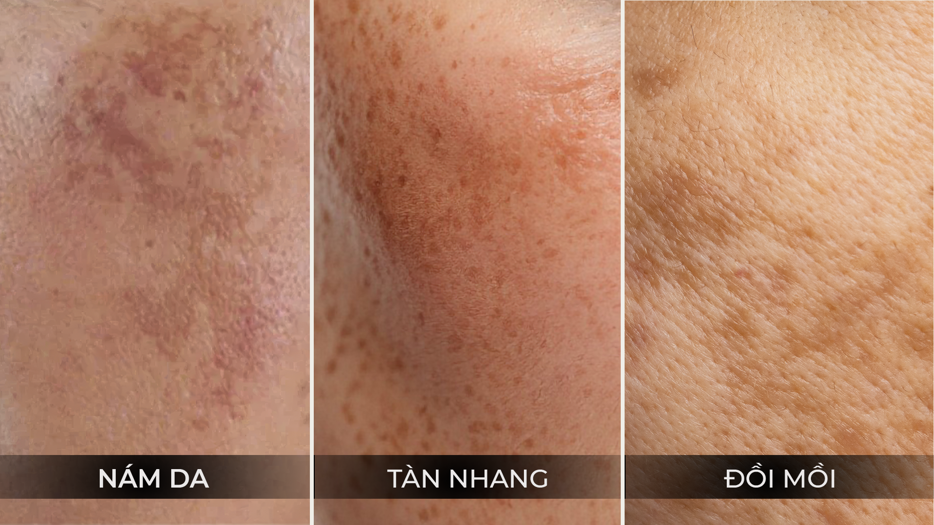 Các vấn đề tăng sắc tố thường gặp