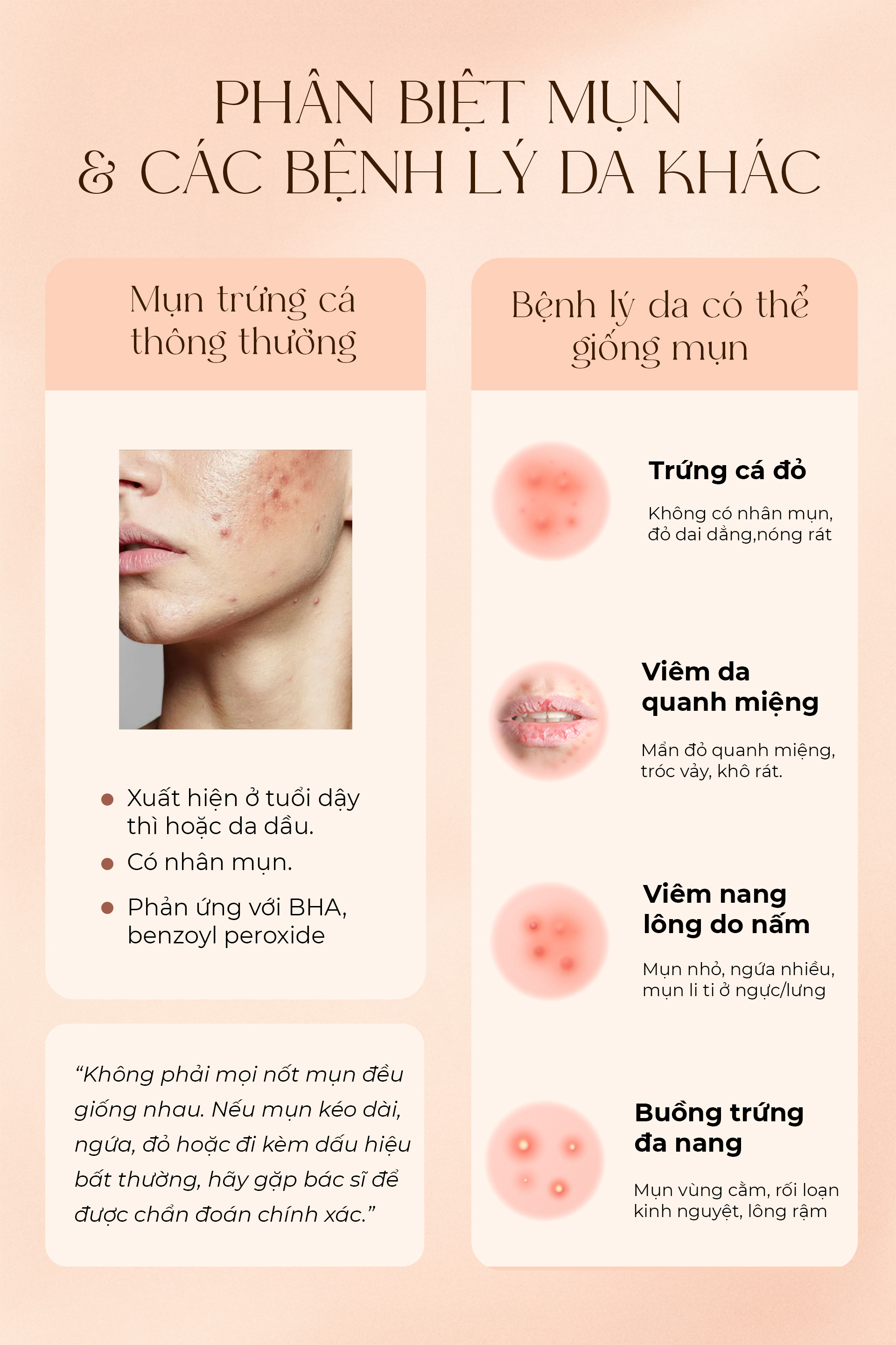 Phân biệt mụn và các bệnh lý da khác.