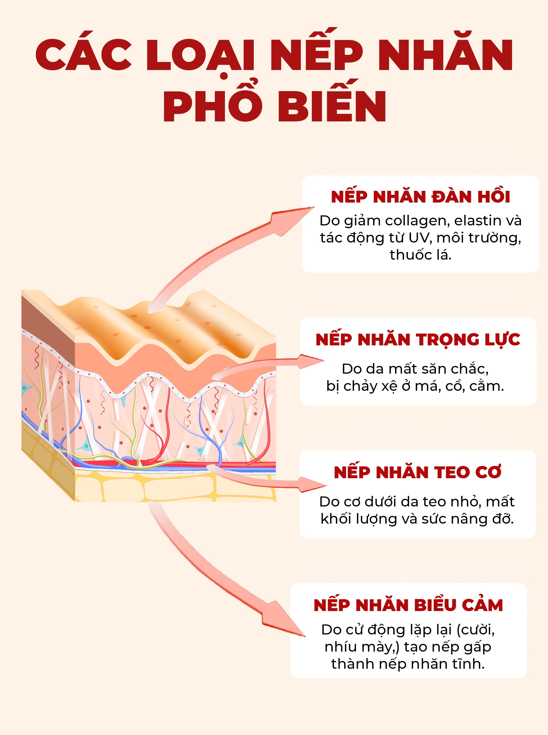 Các loại nếp nhăn phổ biến