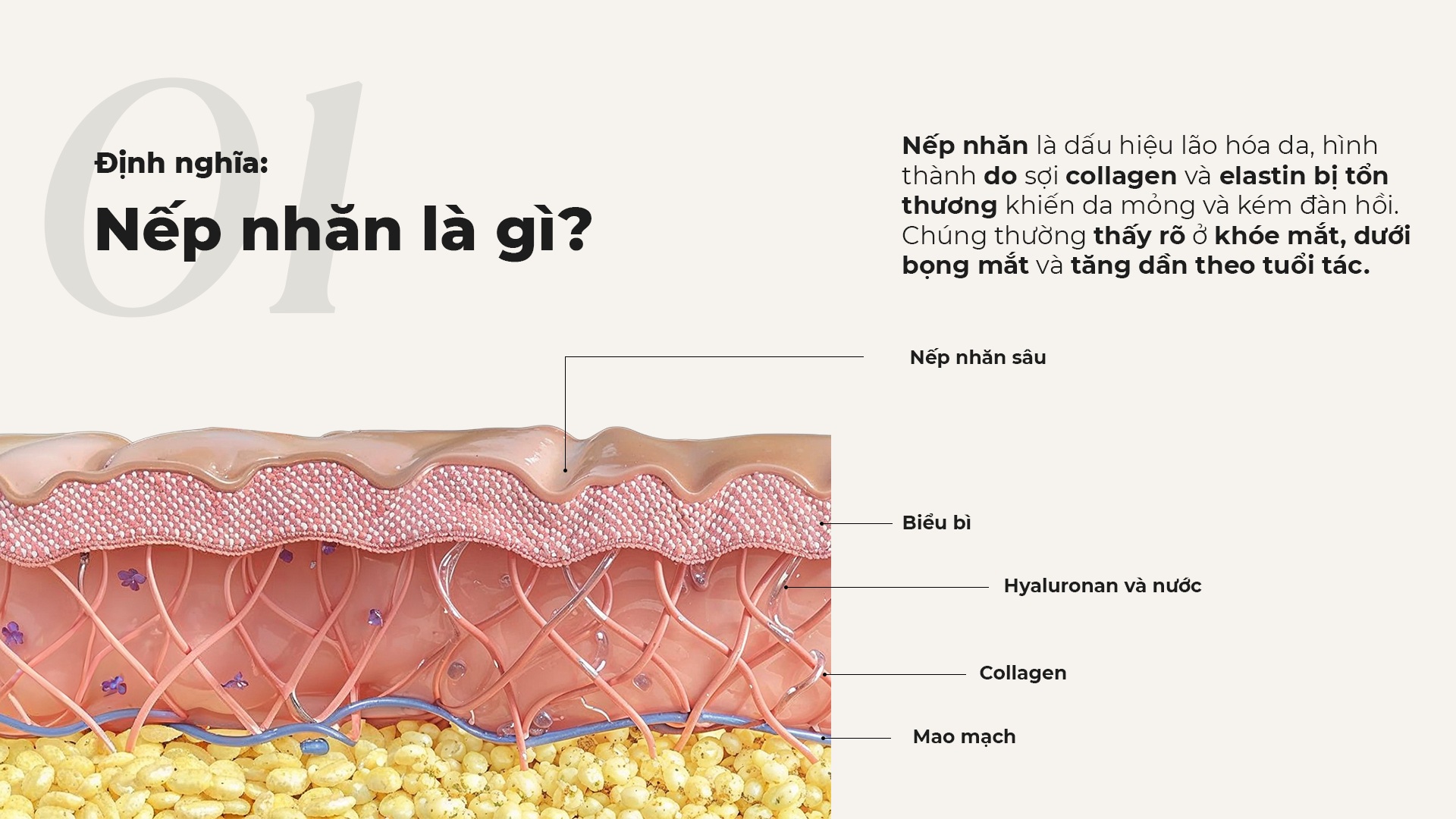 Nếp nhăn là gì?